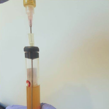 PRP Purification